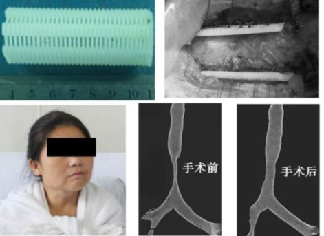 增材制造（3D打印）技术(图10)