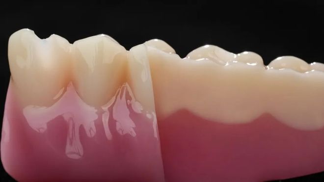 全口义齿一次成型黑格科技突破DLP多材料3D打印技术百亿齿科市场迎来效率革命(图2)