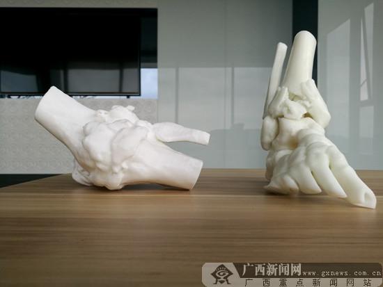 光纤传感器可同时读取多种生物标志物