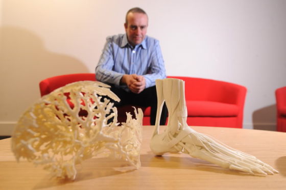 用“AI+3D打印”技术研发智能化康复辅具