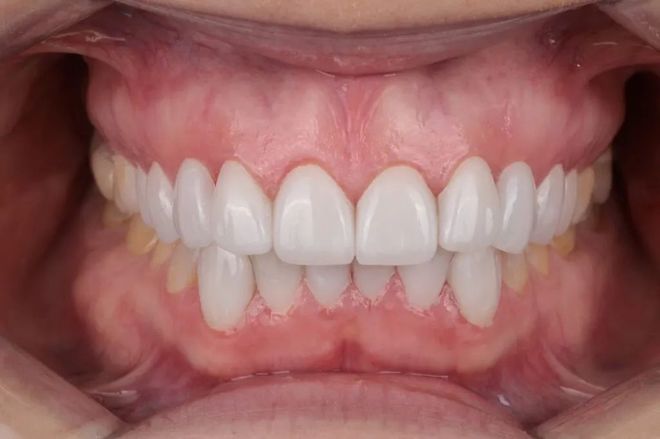 早报|拓竹H2C多头3D打印机;国务院:加快“人工智能+”增材制造(图4)