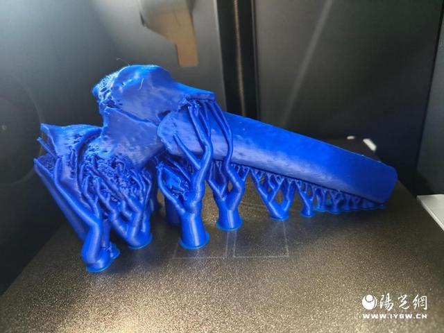 从“看不见”到“精准治” 恒口示范区中心医院3D打印技术惠及骨折患者(图2)
